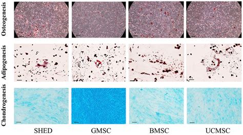 Osteogenic Adipogenic And Chondrogenic Differentiation Of Mscs Mscs