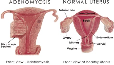 Exam 5 Male And Female Reproductive Pathophysiology Flashcards Quizlet