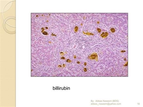 Pathology Ospe Revised Edition Ppt