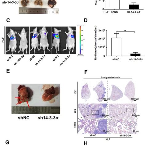 Silencing the 14-3-3σ inhibited HCC growth and lung metastasis in vivo ... 