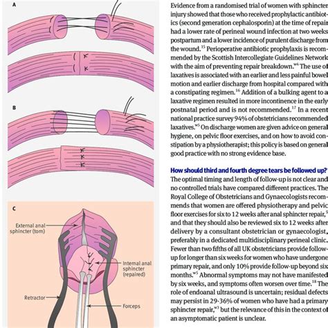 A Third Degree Tear Affecting The Anal Sphincter B Fourth Degree