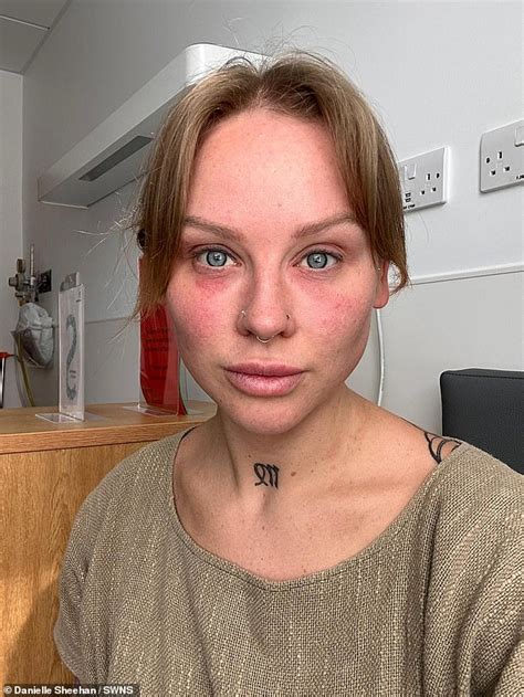 My Boob Job Made Me Feel Like I Was Slowly Dying Mum Was Plagued By Hair Loss Fatigue And