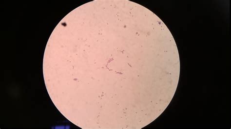 Listeria Monocytogenes Introduction Morphology Pathogenicity