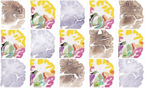 Human Brain Atlas Gets Published All 350 Pages