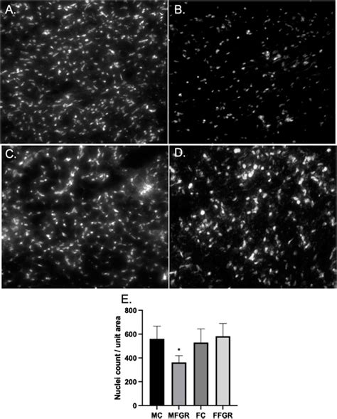 Frontiers Sexual Dimorphic Gene Expression Profile Of Perirenal