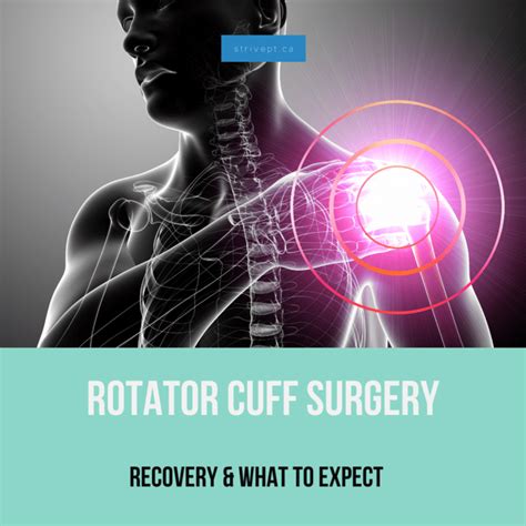 Rotator Cuff Surgery and Recovery : Shoulder Surgery