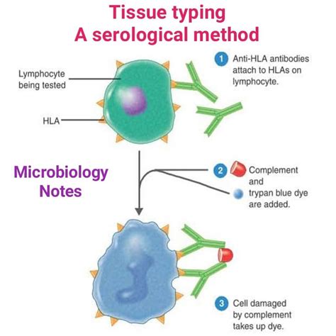 tissue typing  serological method lymphocytes   person