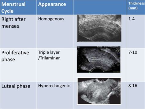 Pin on Sonography