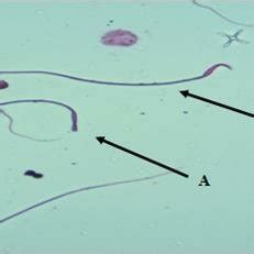 A Section In The Rat Testicle The Control Group Shows The Sperm