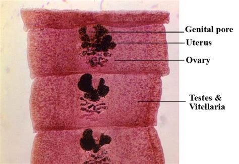 Diphyllobothrium Latum Mature Proglottides Parasitology