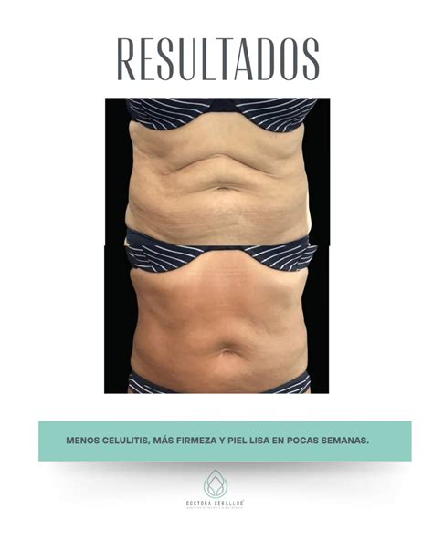 Medicina Estética - María Eugenia Ceballos | Orihuela