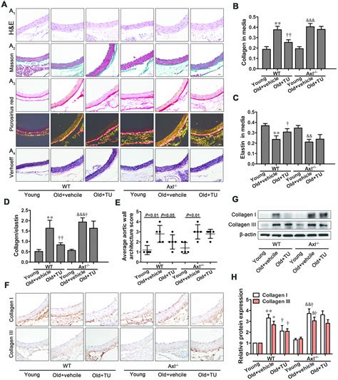 Testosterone Ameliorates Vascular Aging Via The Gas Axl Signaling