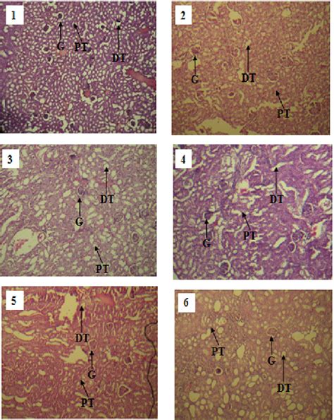 Histopathology Of The Kidney Light Micrographs Of Kidney Sections From