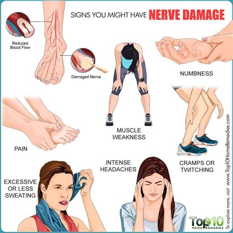 Nerve Damage Symptoms Artofit