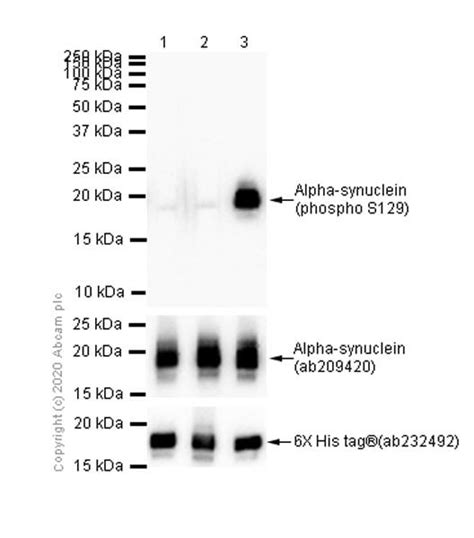 Recombinant Anti Alpha Synuclein Phospho S Antibody Ep Y