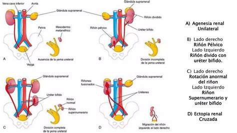 Embriología desarrollo del sistema urogenital PPT