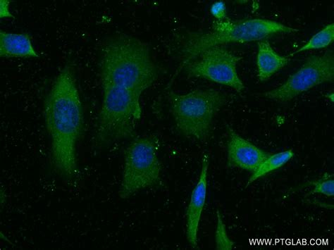 Timp Antibody Rr Proteintech