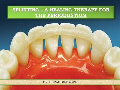 Dental splinting