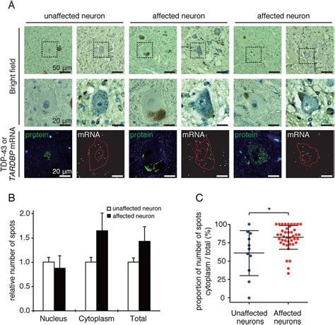 Alteration Of Tardbp Mrna Intracellular Distribution In Motor Neurons Download Scientific