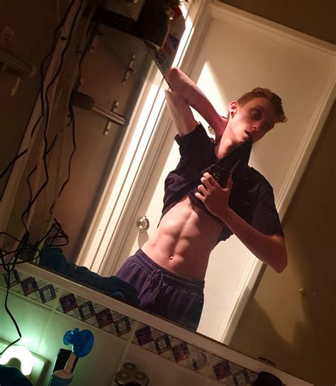 Why doctors are seeing more cases of thumb fasciculations now 13