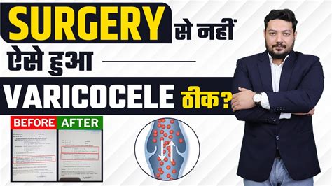 छुपाना नहीं हराना है वैरीकोसेल Varicocele Patient Cured Himanshu