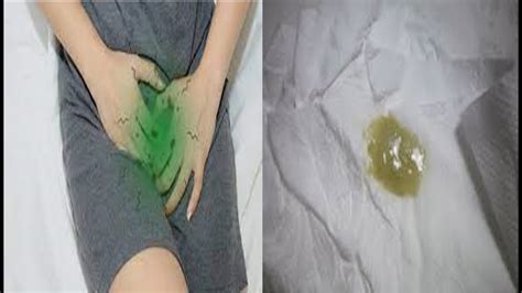 O Que Pode Ser Um Corrimento Esverdeado - Corrimento Com Grumos Verdes - RETOEDU