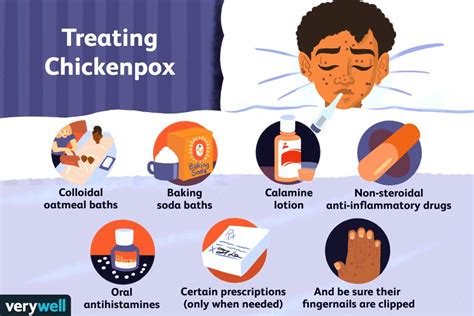 Chicken Pox Tips Page | Hot Sex Picture
