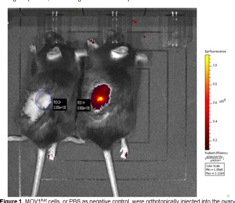 Figure 2 From An Orthotopic Model Of Serous Ovarian Cancer In