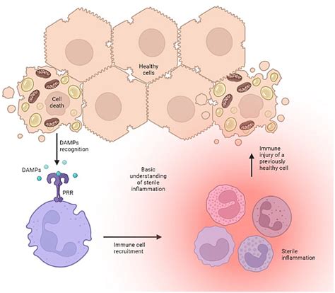 Frontiers Sterile Inflammation In Liver Transplantation