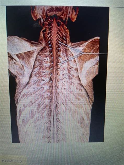 Solved Which Structures Are Highlighteddorsal Root