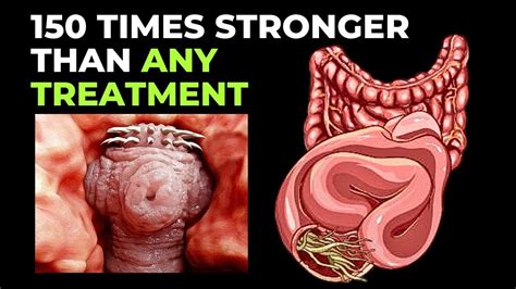 Kill Bad Bacteria In The Gut 3 Day Gut Reset 200 Times Stronger Than