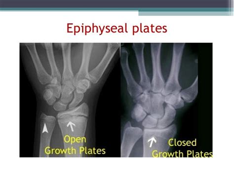anatomy physiology lecture notes skeletal system