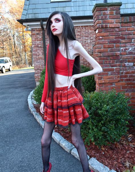 Eugenia Cooney: Everything you need to know about the Anorexic