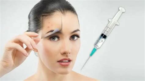 Holes in the skin: causes and treatment. How to get rid of post-acne ...