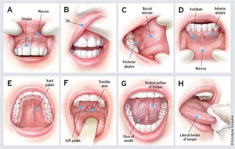 Lump Under Tongue On Floor Of Mouth | Viewfloor.co