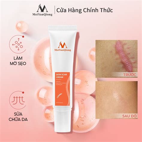 Meiyanqiong Acne Scar Removal Cream Skin Repair Stretch Marks Gi M S O