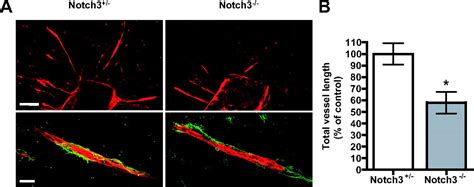 Notch Is Critical For Proper Angiogenesis And Mural Cell Investment