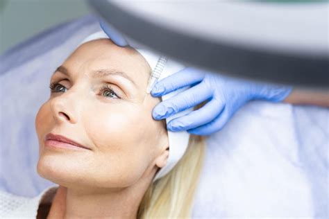 face lift  local anesthesia    smart plastic surgery