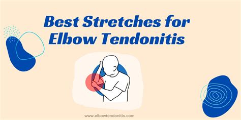 Best Stretches For Elbow Tendonitis A Comprehensive Guide