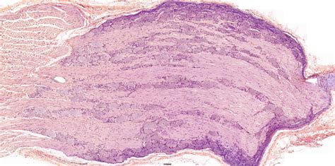 Pin On Histology Spinal Cord And Ganglion