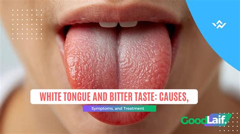 white tongue  bitter taste  symptoms  treatment reach