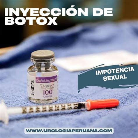 El Botox Puede Ayudar En El Tratamiento De La Impotencia Sexual