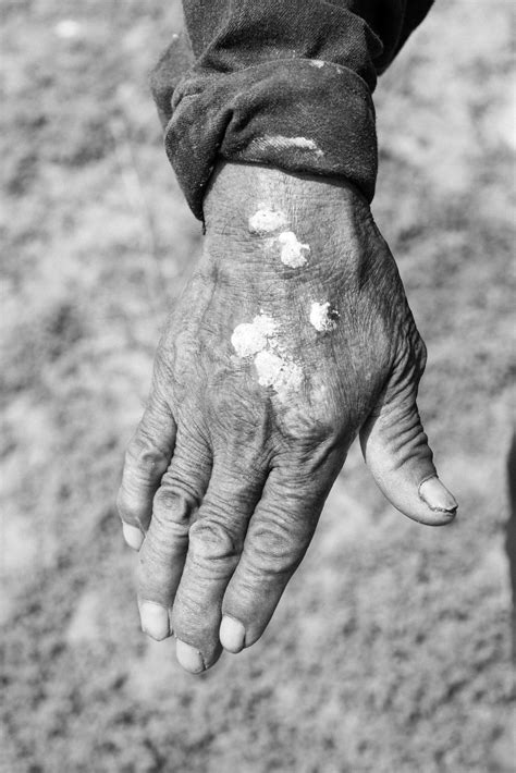 Photos: Inside Mexico City’s water crisis