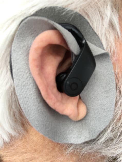 skin irratations and itchy ears from powe… - Apple Community