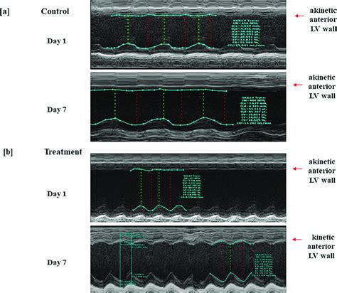 M Mode Images Were Taken From Animals That Underwent Lad Ligation And