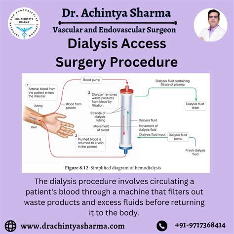 Dialysis Access Surgery Of Patients With Disease An Understanding