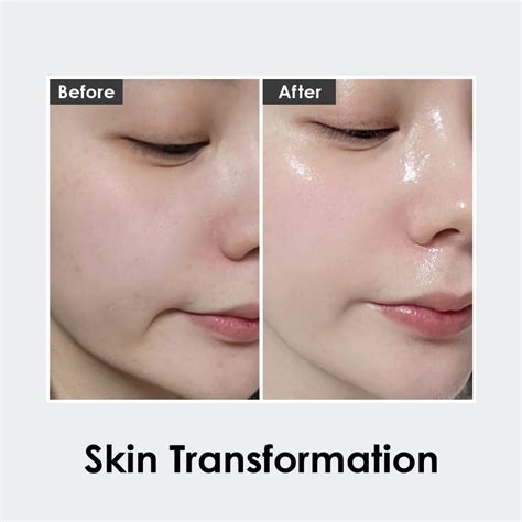 Medi-Peel Peptide 9 Volume Tox Bio Ampule PRO 100 ml - sérum proti vráskám.