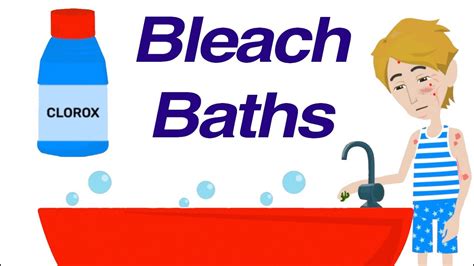 Bleach Baths For Recurrent Skin Infections Youtube