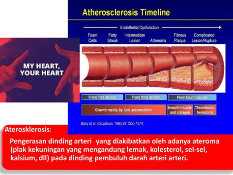 Mengenali Tanda Dan Gejala Serangan Dini Penyakit Jantung Dr Bambang Pptx