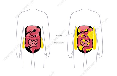 Visceral Fat Diagram Illustration Stock Image F Science